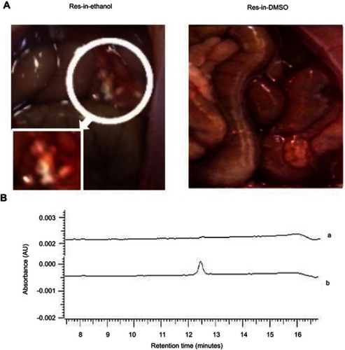 Figure 3 HPLC identification of trans-resveratrol in abdominal white plaques of Res-in-ethanol-treated rats. (A) Arrow indicates widely distributed white plaques on the surface of the peritoneal serosa of Res-in-ethanol treated rats (left), but not in Res-in-DMSO-treated rats (right). Inset, circled region at higher magnification (×80). (B) HPLC analysis of collected white plaques revealed a single peak that corresponded to trans-resveratrol. a, Control; b. Res-in-ethanol.Abbreviations: AU, absorbance retention time; HPLC, high performance liquid chromatography; Res, resveratrol.