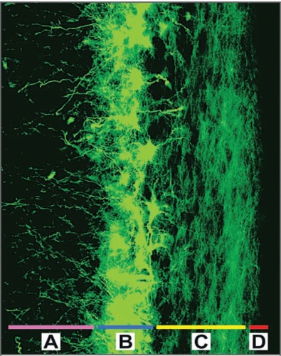 Figure 1 The cells of the subventricular zone, labeled with the astrocyte marker GFAP (shown in green), line the lateral walls of the lateral ventricles. This is the largest known region of adult neural stem cells in the human brain; it is composed of the deep subcortical white matter A), a periventricular ribbon of astrocytes that can function as neural stem cells B), a dense layer of astrocytic processes C), and the ependymal lining D). Throughout adult life, astrocytes from the subventricular zone exhibit a unique capacity for multipotency and self-renewal in vitro. Copyright © 2005. Reproduced with permission from CitationSanai N, Alvarez-Buylla A, Berger M. 2005. Neural stem cells and the origin of gliomas. N Engl J Med, 353:811–22.