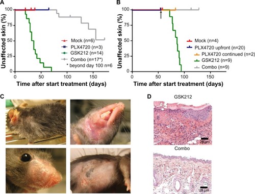 Figure 2 MEKi-associated skin toxicity can be reduced by addition of BRSFi.