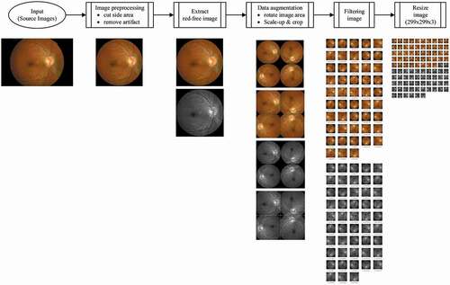 Figure 1. An overview of the image processing flow in the current study. The final image for convolutional neural network architecture of each photograph was prepared by image preprocessing, red-free channel extraction, data augmentation, filtering, and resizing process