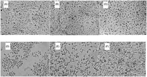 Figure 9. Morphologic changes of endothelial cells. Endothelial cells were incubated with 200 μL basic medium alone (A), 100 μL Hb (62.5 μmol/L) (B), 50 μL PolyHb-Tempol (62.5 μmol/L) (C), 50 μL xanthine/xanthine oxidase (D), 50 μL Hb and 50 μL xanthine/xanthine oxidase (E), or 50 μL PolyHb-Tempol (62.5 μmol/L) and 50 μL xanthine/xanthine oxidase (F). All volumes were made up to 200 μL with basic medium. Cells were viewed by phase-contrast microscopy and photographed (×40 objective).