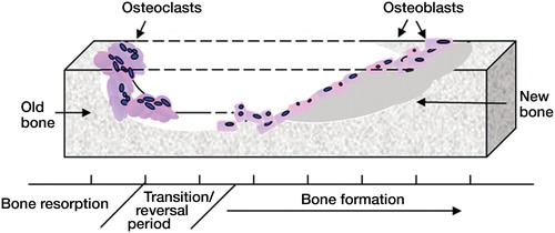 Figure 1. Bone remodeling. Bone is continually remodeled throughout life. The coordinated activity of bone-resorbing osteoclasts and bone-forming osteoblasts ensures that adequate skeletal mass is maintained. As we age, the delicate balance between bone removal and bone production is disrupted, resulting in an overall loss of bone.