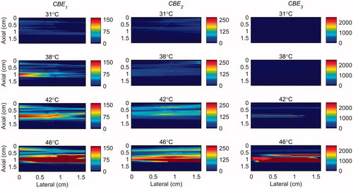 Figure 8. 2 D maps of CBE1 (left), CBE2 (middle), and CBE3 (right) in ex vivo bovine muscle tissue while the temperature was elevated from 26 to 46 °C with the presence of vibration in the tissue. The temperatures measured by the inserted thermocouple were 31, 38, 42 and 46 °C at the center of heated region. The color bars represent percentage change in backscattered energy. The heated region is along the arrow in the lower right panel.