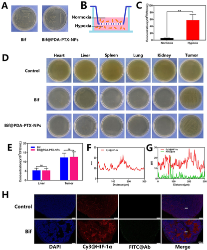 Figure 4 Evaluation of the targeting activity of the Bif@PDA-PTX-NPs biohybrid to hypoxic environment. (A) Anaerobic incubation of Bif and Bif@PDA-PTX-NPs for 24 h. (B) Schematic illustration of the hypoxia simulation model using a Transwell system to evaluate the hypoxic targeting activity of the biohybrid Bif@PDA-PTX-NPs. (C) The number of bacteria migrating to the bottom chamber (hypoxic environment) in a Transwell model. (D) Homogenates of the organs and tumor tissues were cultured on agar plates under a hypoxic environment at 37°C for 2 days. (E) The number of Bif in liver and tumor tissues of mice. (F and G) Bif@PDA-PTX-NPs and hypoxic zone co-localization in vivo. Hypoxic zone was stained in red with Cy3@HIF-1α (Anaerobic induction factors labelled with Cy3), and Bif was stained in green with FITC@Ab (Bifidobacterium infantis antibodies labelled with FITC). (H) Fluorescence co-localization images of Bif@PDA-PTX-NPs and hypoxic regions of tumor (Scale bar=400 μm). Data are presented as mean ± SD (n=3, ns: no statistical significance, **P<0.01).