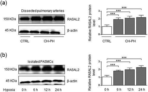 Figure 1. The protein level of Rasal2 is elevated in both dissected pulmonary arteries of pulmonary arterial hypertension (PAH) mice and hypoxia-challenged PASMC. (a) The protein expression levels of Rasal2 in dissected PAs of CH-PH mice were analyzed by immunoblotting (n = 5). (b) The protein expression level of Rasal2 in PASMC exposed to hypoxic conditions for different time courses was analyzed by immunoblotting (n = 5). Data are expressed as mean ± SD. *** indicates a significant difference of P < 0.001 between the two marked groups.
