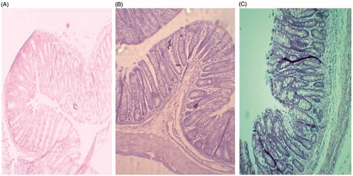 Figure 6. Histological examination of jejunum.