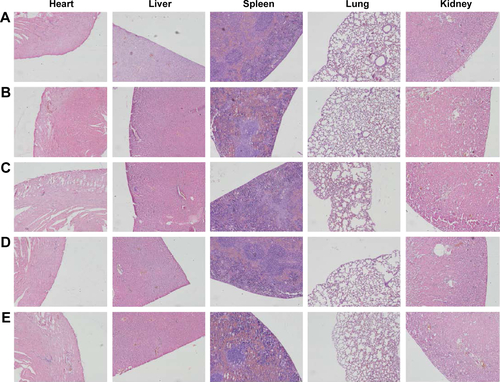 Figure S7 Representative images of H&E-stained sections of the heart, liver, spleen, lung, and kidney collected from tumor-bearing BALB/c mice after treatment with saline (A), LM-PLGA/PPF (B), LM-PLGA/PPF/VEGF shRNA (C), LDM-PLGA/PPF/SC shRNA (D), and LDM-PLGA/PPF/VEGF shRNA (E).Abbreviations: PLGA, poly(d,l-lactic-co-glycolic acid); PPF, PEI-PEG-FA; PEI-PEG-FA, polyethyleneimine premodified with polyethylene glycol-folic acid; SC shRNA, scrambled small hairpin RNA; VEGF, vascular endothelial growth factor.