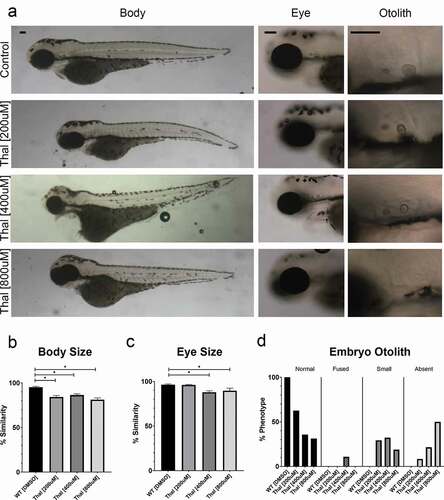 Figure 2. Phenotypes of thalidomide treated embryos overlap with Esco2 KD and Smc3 KD embryos. (a) Representative images of control embryos (WT treated with DMSO) and thalidomide (thal.) treatments (WT treated with 200 μM, 400 μM, and 800 μM concentrations of thalidomide). For all experiments 16–28 replicates were analyzed and at least 3 independent trials were performed. (b) Quantification of body size after drug treatment were compared to un-treated WT embryos to obtain percent similarity. Bar graph reveals a significant reduction of body length with thal. treatments compared to DMSO treated controls (error bars represent s.e.m., one-way ANOVA with Turkey’s multiple comparison, *P < 0.05). (c) Quantification of eye size after drug treatment were compared to un-treated WT embryos to obtain percent similarity. Bar graph reveals a significant reduction of eye size with all thal. treatments compared to DMSO treated controls (error bars represent s.e.m., one-way ANOVA with Turkey’s multiple comparison, *P < 0.05). (d) Graph shows percent of normal, fused, small, or absent otolith phenotypes with drug treatments. Data reveals 100% of control embryo otoliths exhibit normal phenotype, while 200 μM, 400 μM, and 800 μM thal. treatments had 31%, 36% and 63% normal otolith phenotypes, respectively. An increase in absent otolith phenotypes was observed with increasing concentrations of thalidomide. Scale bar: 100 μm.