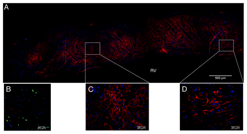 Figure 11. α-actinin staining of UBM patches at 16 weeks after surgery. (A) The patched area shows evidence of organized sarcomere structure (red) within cardiomyocytes. (B)GFP + cells (green) can be observed within the patch, but are not associated with actinin staining. (C and D) Insets from multiple areas throughout the patch show striated actinin structure within cardiomyocytes (draq5-blue). Scale indicates 500 µm and 25 μm within insets.