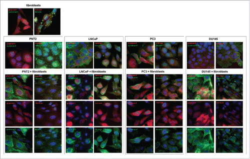 Figure 4. Immunocytochemical analysis of proteoglycans expression in fibroblasts (FB) and normal (PNT2) and cancer prostate cells (LNCaP, PC3, DU145) before and after coculture with fibroblasts. Decorin (green), lumican (red), syndecan-1 (green), glypican-1 (red). Nuclear counterstain - DAPI (blue).