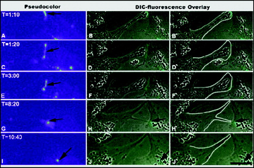 Figure 5.  Gap junction plaque internalization during cell detachment. Gap junction plaque internalization (arrow) was observed as a cell process detached from the cell body of another cell. Pseudocolor (A, C, E, G, I) and corresponding DIC-fluorescent overlay with (B′, D′, F′, H′, J′) and without (B, D, F, H, J) the plasma membrane of one of cell outlined are demonstrated. Cells were imaged 48 h post transfection. Bar = 5 µm. In the movie, gap junction plaque internalization can be followed as a cell process detaches from the cell body of another cell.