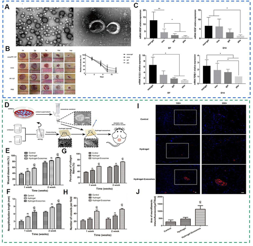 Figure 6 Stem cell-derived exosome-bound hydrogel promotes chronic diabetic wound healing; (A) Electron microscopy images of hUCMSCs-exos; (B) Detection of wound healing rate. (C) VEGF and TGFβ-1 expression levels. Reproduced with permission from Dove Medical Press. Yang J, Chen Z, Pan D, Li H, Shen J. Umbilical Cord-Derived Mesenchymal Stem Cell-Derived Exosomes Combined Pluronic F127 Hydrogel Promote Chronic Diabetic Wound Healing and Complete Skin Regeneration. IJN. 2020;15:5911–5926.Citation101 (D)Schematic illustration of the isolation of GMSC-derived exosomes and preparation of chitosan/silk hydrogel; (E) Quantitative analysis of the wound closure rates; (F) Quantitative analysis of the total length in the three groups at each time point.; (G) Quantitative analysis of the percentage of collagen in each group at each time point; (H) Quantitative analysis of the number of microvessels per field; (I) Representative immunofluorescent images of neurofilament heavy chain (red fluorescence) were detected at 2 weeks post-surgery; (J) Quantitative analysis of the nerve fiber density in each group at 2 weeks post-surgery. a, P < 0.05 compared to the control group; b, P < 0.05 compared to the hydrogel group. Reproduced from Shi Q, Qian Z, Liu D, et al. GMSC-Derived Exosomes Combined with a Chitosan/Silk Hydrogel Sponge Accelerates Wound Healing in a Diabetic Rat Skin Defect Model. Front Physiol. 2017;8:904. © 2017 Shi, Qian, Liu, Sun, Wang, Liu, Xu and Guo. Creative Commons Attribution License (CC BY).Citation102