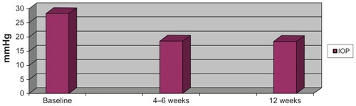 Figure 1 Mean IOP at baseline, 4–6 weeks, and 12 weeks.