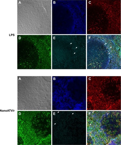 Figure 6 Immunofluorescence staining of FAPM biodistribution in LPS-treated mouse spleen (top) or nanoATV/r treated mouse spleen (bottom).Notes: (A) Phase contrast; (B) DAPI; (C) Iba-1; (D) folate receptor 2; (E) magnetite (arrow indicates individual magnetite); and (F) merged picture. 200×, white arrows indicate colocalized stains.Abbreviations: FAPM, ALN-PEG-FA-coated magnetite; LPS, lipopolysaccharide; nanoATV/r, nanoformulated ritonavir (RTV)-boosted atazanavir (ATV); DAPI, 4′,6-diamidino-2-phenylindole; Iba-1, ionized calcium-binding adaptor molecule 1; ALN, alendronate; PEG, polyethylene glycol; FA, folic acid.