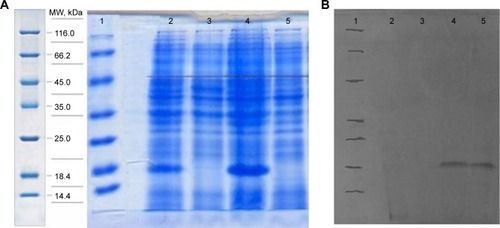 Figure 2 SDS-Page and Western blot analysis.