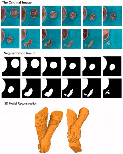 Figure 9. Arm image segmentation and 3D construction of male virtual human in China.