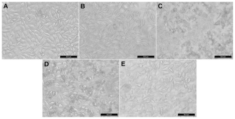 Figure 6 Phase-contrast photomicrograph of (A) untreated L929 cells (phosphate-buffered control) and L929 cells treated with 100 μg/mL of (B) nanohydroxyapatite, (C) nanohydroxyapatite-aminopropyltriethoxysilane, (D) neutralized nanohydroxyapatite-aminopropyltriethoxysilane, and (E) negatively charged nanohydroxyapatite-aminopropyltriethoxysilane for 24 hours, respectively.