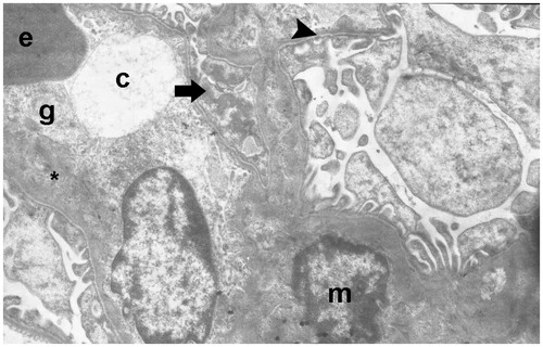 Figure 16. (Electron micrographs show sham group ultrastructure). Electron micrographs showing peritubular capillary with normal basal lamina (arrow head) in a control. Electron microscopic findings show typical podocyte foot process (arrow). Capillary (c). Erythrocyte 3000×.