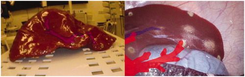 Figure 2. Frames of AR showing re-projected blood vessel structures in the phantom (left) and the in vivo study (right).