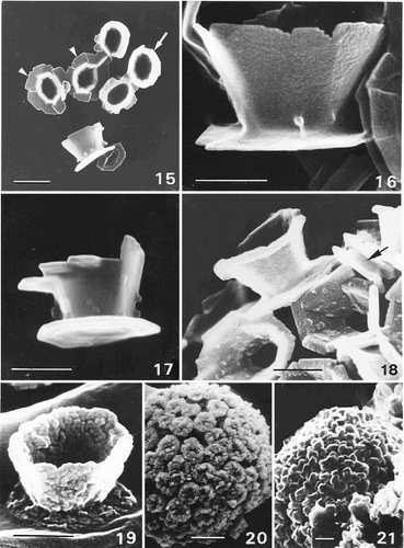 Figs 15–21. SEM observations of Ochrosphaera neapolitana coccoliths. Fig. 15. Group of coccoliths showing vase-shaped coccoliths with external protrusions in profile and from above (arrow) and two pulley-shaped coccoliths in surface view (arrowheads). Fig. 16. Detail of a vase-shaped coccolith in profile. Fig. 17. ‘Intermediate’ coccolith. Fig. 18. West's strain after one month of culture exhibiting small protrusions on the coccoliths. Pulley-shaped coccolith with a small distal flange (arrow). Fig. 19. Increasingly over-calcified coccolith. Fig. 20. Highly over-calcified coccosphere in which the central cavities of the coccoliths are almost filled. Fig. 21. Pseudocyst in which individual coccoliths are no longer recognisable. Scale bars represent 1 µm (Fig. 15), 0.5 µm (Figs 16–19) and 2 µm (Figs 20, 21).