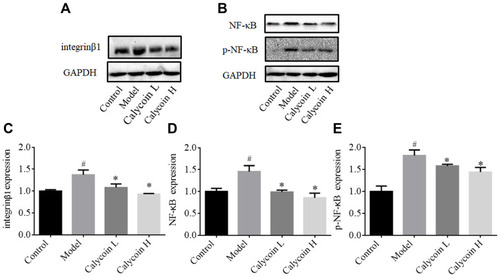 Figure 7 Effects of calycosin on integrin β1, NF-κB, and p-NF-κB in the gastric mucosa of PLGC rats. (A and B) Western blot analysis of integrin β1, NF-κB, and p-NF-κB protein levels in PLGC groups after treatment with calycosin. (C–E) Quantitative analysis of integrin β1 (C), NF-κB (D) and  p-NF-κB (E). Expression was standardized to GAPDH expression. Data are shown as the mean ± SD (n = 3 rats per group). #P < 0.05 versus the control group. *P < 0.05 versus the model group.