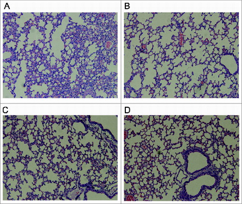 Figure 5. Histopathologic alterations in the lungs of mice injected with 0.5 mg of rATA (A), 1 mg of tATA4 (B), 1 mg of tATA1(C), and PBS alone (D). (A) Epithelial necrosis, generalized interstitial edema, partial consolidation and moderate intra-alveolar hemorrhage; (B), (C), and (D) (control): no obvious edema or necrosis.