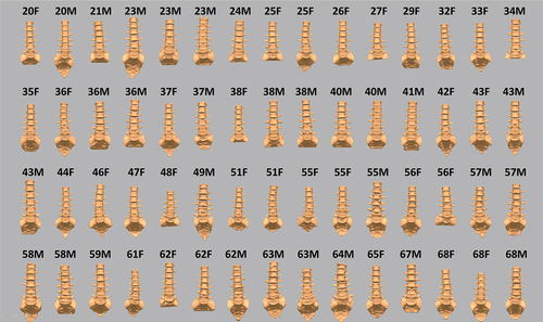 Figure 2. Spine geometry database. The label above each spine identifies the subject age and gender.