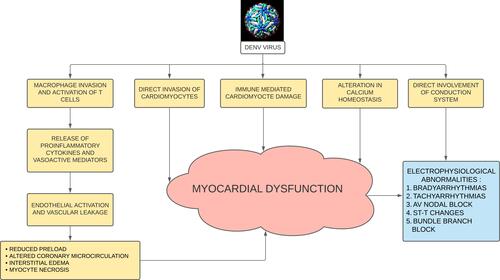 Figure 1 Proposed pathogenesis of conduction abnormalities in dengue fever.