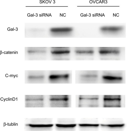 Figure 3 Protein expressions of Wnt pathway molecules after downregulation of Gal-3 in ovarian cancer cell lines.Notes: Downregulating Gal-3 expression attenuates β-catenin expression in ovarian epithelial cancer cells SKOV3 and OVCAR3; c-myc and cyclin D1 which are both downstream proteins in Wnt pathways are downregulated.Abbreviations: Gal-3, galectin-3; NC, negative control; siRNA, small interfering RNA.