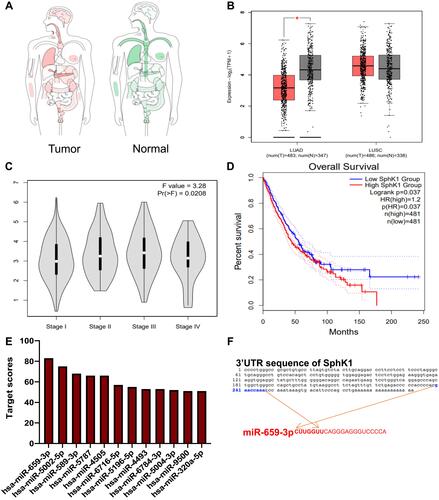 Figure 2 SphK1 expression in lung cancer from GEPIA2 database and interaction with miRNA. (A) The median expression of SphK1 tumor and normal samples in bodymap. Red represents upregulation and green represents down-regulation. (B) GEPIA2 database was used to obtain the SphK1 expression levels in lung cancer and normal tissues. (C) SphK1 expression at different stage of lung cancer. (D) Kaplan-Meier analysis of the overall survival of lung cancer patients based on SphK1 expression in GEPIA2 database. (E) SphK1 is predicted to be targeted by 12 miRNAs in miRDB. (F) Target site analysis between SphK1 and miR-659-3p.