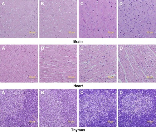 Figure 6 Histologic sections of brain, heart, and thymus.Notes: (A) Male rats of nano-Cu/LDPE group. (B) Male rats of control group. (C) Female rats of nano-Cu/LDPE group. (D) Female rats of control group. No statistically significant changes were detected in any groups.Abbreviation: Cu/LDPE, copper/low-density polyethylene nanocomposite.