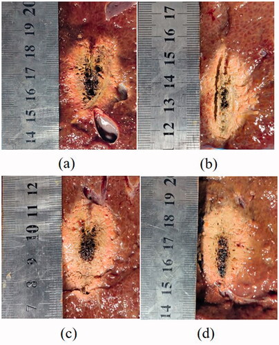 Figure 4. Effective coagulation zone and charring tissue formation of porcine liver after various MWA procedures of (a) continuous mode at 50 W; (b) intermittent mode with temperature control at 50 W; (c) continuous mode at 60 W; and (d) intermittent mode with temperature control with 60 W. The cumulative ablation time of 300 s were maintained for all the treatments.