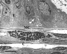 Figure 4 Electron microscopy of intestinal mucosa to assess epithelial damage. Typical electron micrograph of transverse section through intestinal villus (away from Peyers' patch) from rat injected with a 5 ml bolus of HBS-2% BSA (Hepes buffered saline containing 2% bovine serum albumin). The epithelium (E) is mostly intact and an intact mast cell (MC) is visible. Capillary cross-sections (C) can also be seen. Villi close to Peyers' patches were similar in appearance; Scale bar: 5 microns.