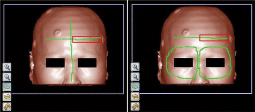 Figure 1. Three-dimensional visualization of the CT volume data and illustration of the original position of PClaser in the image space. The green lines in the left and right panels are the original positions of PClaser1 and PClaser2, respectively. In each case, the portion of the green line falling within the red rectangle is the area where anisotropic errors were added.