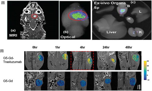 Figure 3. In vivo MRI images of dendrimer-based NPs in cancer model (i) (a) the coronal MRI images shows the location of U-251 glioma tumour, (b) distribution of G3-curcumin in organs and (c) fluorescence images of kidney (K), spleen (Sp), liver, heart (H), lung (L) and brain and (B) in rat model – reprinted from reference [Citation92], copyright 2016, PubMed Central; and (ii) G5-Gd trastuzumab and G5-Gd NPs injected tumour bearing mice model – reprinted from reference [Citation93], copyright 2020, Springer Nature).