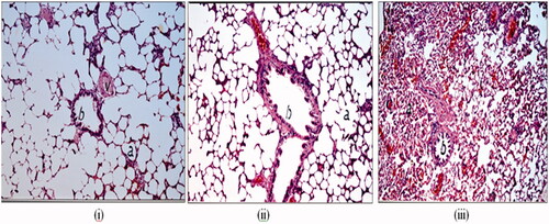 Figure 4. Histological microscopic features of rat lung tissue after intratracheal administration of PBS as a negative control (i), oral administration of oral bosentan suspension (ii) and intratracheal administration of bosentan RCRPC (iii).