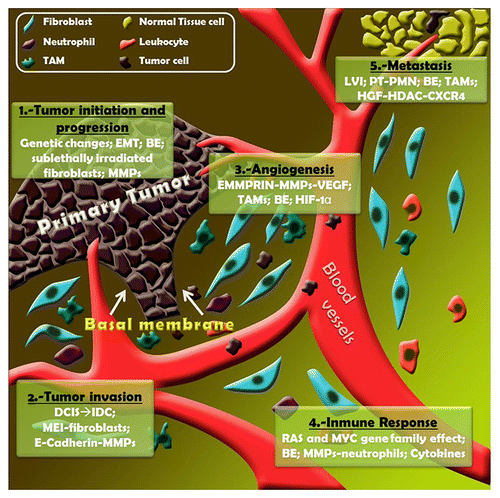 Figure 1. Microenvironmental players in breast cancer development. (1) Tumor initiation and progression: genetic changes involved (genetic profile changes, microsatellite instability, tumor suppressor gene and oncogene point mutations, LOH); epithelial to mesenchymal transition (EMT); bystander effects (BEs) are related to soluble factors (TNFα, free radicals -ROS, RNS-); sublethally-irradiated fibroblasts enhance tumor growth; metalloproteinases (MMPs) control the growth-antigrowth balance. (2) Tumor invasion: DCIS to IDC transition is associated with stromal gene expression changes; MMPs are responsible for altering extracellular matrix remodeling; mesenchymal-epithelial interactions (MEIs) are a consequence of the transcriptional response of fibroblasts to Wnt signals; E-cadherin cleavage is produced by MMPs. (3) Angiogenesis: extracellular matrix metalloproteinase inducer (EMMPRIN) appears to modulate VEGF secretion in an MMP-dependent manner; hypoxic conditions stimulate HIF-1α production by TAMs. (4) Immune response: leukocyte recruitment and tumor microenvironment (TME) remodeling is performed by some members of RAS and MYC gene families; Some MMPs modulate the bioactivity of CXCL-1/KC and CXCL-8/IL-8 implicated in chemotactic activity on neutrophils; cytokines control the immune and inflammatory milieu. (5) Metastasis: lymphovascular invasion (LVI) is related to the presence of lymph node metastasis and is a marker of poor prognosis. Mobilization of bone marrow-derived cells induced by primary tumor (PT) generates pre-metastatic niche (PMN); epigenetics regulation; HGF-HDAC-CXCR-4 interactions related to invasive phenotype.