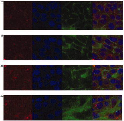 Figure 5. Confocal microscopy images of cell uptake of fluorescein only (Fl, panels A and B) and ELP-fluorescein (ELPVA40-60-(Asp)6Fl9 conjugates, panels C and D). Images were taken after 4 h (panels A and C) and 48 h (panels B and D) incubation. For each panel, images from left to right showing lysosome (red, lysosomes-RFP); cell nuclei (blue, Hoechst); fluorescein (green, Fl or ELP-Fl); merge (yellow and orange). scale bar: 20 μm.