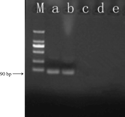 Figure 2. Specificity of GNPA using PCR detection. Signal DNA bound on GNP probe was analyzed using PCR. (Lanes a and b) Ricin A chain of two duplicates. (Lane c) Camphorin protein. (Lane d) Ebulitin protein. (Lane e) Blank control. (Lane m): DL2000 DNA marker.