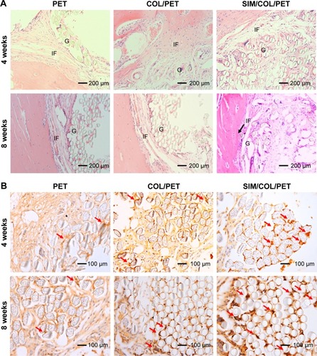 Figure 7 Histological and immunohistological assessments.Notes: (A) Hematoxylin and eosin staining evaluation of the graft–bone interface at 4 weeks and 8 weeks after surgery (magnification, ×200). The black arrow shows the tendon–bone interface. (B) Immunohistochemical staining of the osteogenic and angiogenesis marker, VEGF, at 4 weeks and 8 weeks after surgery (magnification, ×100). The brown precipitate represented stained VEGF (red arrows).Abbreviations: G, artificial ligament graft; IF, interface; VEGF, vascular endothelial growth factor; PET, polyethylene terephthalate; COL/PET, collagen coating on polyethylene terephthalate scaffolds; SIM/COL/PET, collagen and simvastatin microspheres coating on polyethylene terephthalate scaffolds.