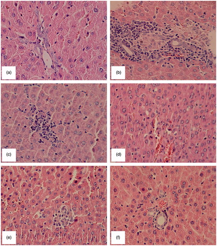 Figure 1. Microscopic structure of liver of a (a) control rat (group 1) and (b) diabetic rat (group 2) showing marked portal areas, mild piecemeal necrosis, and 1–4 foci per field; (c) PH-treated diabetic rat (group 3) showing moderate portal areas, mild piecemeal necrosis, and 1–4 foci per field; (d) RC-treated diabetic rat (group 4) showing mild portal areas and 1–4 foci per field; (e) UD-treated diabetic rat (group 5) showing moderate portal areas, mild piecemeal necrosis, and 1–4 foci per field; (f) triplex mixture-treated diabetic rat (group 6) showing mild portal areas. All slides stained with hematoxylin and eosin (original magnification ×10).