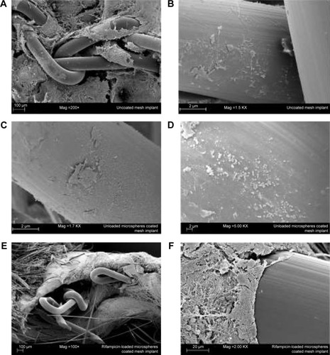 Figure 6 Scanning electron microscopy micrographs of different explanted mesh implants.