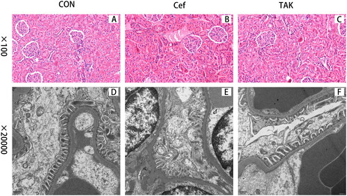 Figure 7. Representative micrographs for Histopathological changes of kidney from the three groups. (A-C) Representative features of CON, Cef, TAK group with light microscopy, (D-F) electron micrographs.