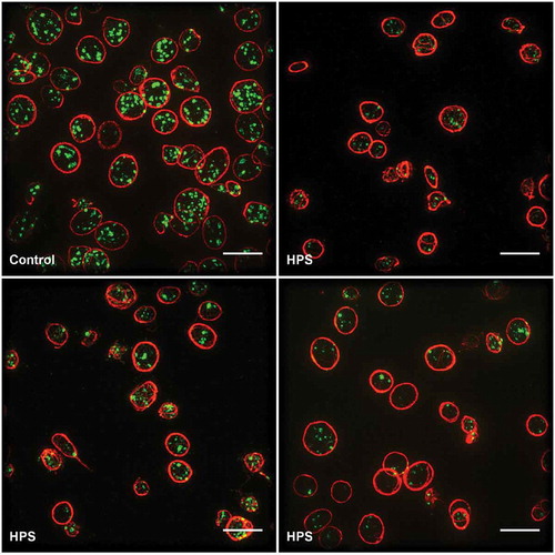 Figure 4. Comparison of platelets from healthy controls and HPS patients.Top left, a healthy control; top right through bottom right, HPS patients. Scale bars all 5 µm. Note the markedly more abundant and brightly stained CD63-positive granules in the platelets of the healthy control.