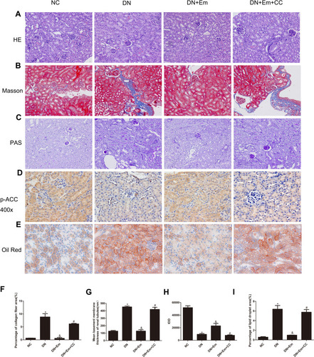 Figure 2 Histopathological examination of renal tissue in mice in the negative control (NC), diabetic (DN), diabetic plus empagliflozin (DN+Em) and diabetic plus empagliflozin plus compound C (DN+Em+CC) groups. (A–E) Representative photomicrographs showing H&E, Masson’s trichrome, PAS, immunohistochemical staining for AdipoR1 (400×) and oil red O staining. All images are magnified 200×. (F–I) Quantification of the Masson’s trichrome, PAS, immunohistochemical staining for AdipoR1 and oil red O staining results. *p < 0.05 vs NC; &p < 0.05 vs DN; #p < 0.05 vs DN+Em.