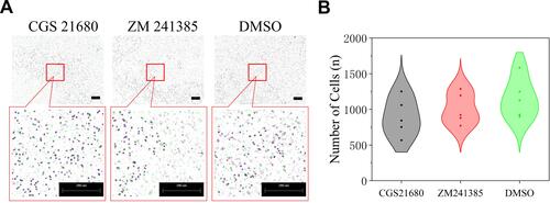 Figure 3 The role of ADA2AR on VECs migration in bone fracture environment in vitro. (A) CGS21680 and ZM241385 could not promote cell migration at 48h. (B) The violin plots showed the the difference between groups, *p<0.05. Transwell images, ×50; original scale bar, 200 μm. n=5 for each group.