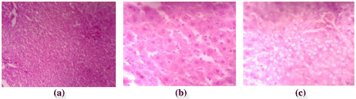 Figure 3. Histopathology of liver: (a) control, (b) low dose and (c) high dose.