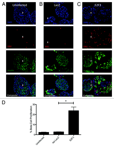 Figure 4.E2F3 induced proliferation in rat islets. (A–C) Representative pictures of paraffin embedded sections for uninfected (MOI 0) (A), ad-LacZ infected (MOI 500) (B) and ad-E2F3 (MOI 500) (C) stained for DNA stained with DAPI (blue) EdU (red), and insulin (green). (D) Quantification of immunohistochemistry for EdU+/insulin+ cells. % β-cell proliferation represents the number of cells that co-stained for EdU and insulin over the total number of insulin-positive cells, *P = 0.004. White arrows, sample EdU/Insulin positive nuclei. n = 3 islet preparations