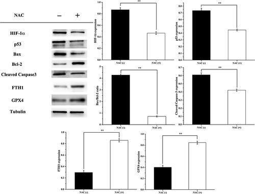 Figure 13. Effects of apoptosis and ferroptosis related protein expression levels in MCF-7 cells treated by Fe3O4@mSiO2-NH2-FA-TAX under the action of magnetic fields with and without NAC treatment. (−) means not treated by NAC, (+) means treated by NAC (n = 3, **P < .01, comparison between groups).