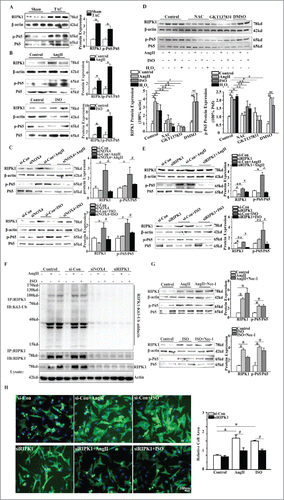 Figure 4. NOX4 activated RIPK1-related NF-κB signaling pathways in cardiac hypertrophy. (A) Western blotting analysis for RIPK1 and phosphorylated P65 subunit of NF-κB in rats 4 weeks after TAC or sham surgery. n = 6. * indicates P<0.05 vs. sham-operated group. (B) Western blotting analysis for RIPK1 and phosphorylated P65 subunit of NF-κB in NCMs treated with AngII (10−5M for 24h, Top) or ISO (10−5M for 24h, Bottom). n = 4. * indicates P<0.05 vs. control. (C) Western blotting analysis for RIPK1 and phosphorylated P65 subunit of NF-κB in NCMs in the presence or absence of AngII (10−5M for 24h, Top) or ISO (10−5M for 24h, Bottom) after transfected with si-Con or siNOX4. n = 4. * indicates P<0.05 vs. si-Con, # indicates P<0.05 vs. si-Con+AngII or si-Con+ISO. (D) Western blotting analysis for RIPK1 related NF-κB signaling in NCMs. NCMs treated with AngII (10−5M for 24h), ISO (10−5M for 24h) or H2O2 (100μM for 2h) showed significantly higher activation of RIPK1/NF-κB signaling compared to blank group. The activation of RIPK1/NF-κB signaling was restored by pretreatment with either NAC (10mM for 1h) or GKT137831(5μM for 1h). n = 3. *, ## indicates P<0.05 vs. blank and DMSO group, respectively; ** indicates P<0.05(AngII, ISO and H2O2 group vs. AngII+NAC, ISO+NAC and H2O2+NAC group, respectively); # indicates P<0.05(AngII and ISO vs. AngII+GKT137831 and ISO+ GKT137831 group, respectively). (E) Western blotting analysis for RIPK1 and phosphorylated P65 subunit of NF-κB in NCMs in the presence or absence of AngII (10−5M for 24h, Top) or ISO (10−5M for 24h, Bottom) after transfected with si-Con or siRIPK1. n = 4. *, ** indicates P<0.05 vs. si-Con, # indicates P<0.05 vs. si-Con+AngII or si-Con+ISO. (F) Immunoprecipitation analysis for K63-linked polyubiquitination of RIPK1. RIPK1 immunoprecipitates from whole-cell lysates of NCMs were subjected to Western blotting. NCMs treated with AngII (10−5M for 24h) or ISO (10−5M for 24h) showed significantly higher K63-linked polyubiquitination of RIPK1 as compared to control group. The polyubiquitination of RIPK1 was restored by transfection of si-Con or siNOX4 into NCMs treated with AngII (10−5M for 24h) or ISO (10−5M for 24h). (G) Western blotting analysis for RIPK1 and phosphorylated P65 subunit of NF-κB in NCMs treated with AngII (10−5M for24h, Top) or ISO (10−5M for 24h, Bottom) after pretreatment of Nec-1(10nM). n = 4. * indicates P<0.05 vs. control. (H) Surface area determination of NCMs in the presence or absence of AngII(10−5M for 24h) or ISO (10−5M for 24h) after transfected with si-Con or siRIPK1. n = 4. The fluorescent micrograph is representative of cells from 4 independent visual fields. * indicates P<0.05 vs. si-Con; # indicates P<0.05 vs. si-Con+AngII or si-Con+ISO.